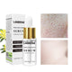 Pore Treatment Serum Essence Shrink