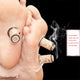 Massage Moxibustion Roll Sticks Burner Box Device