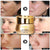 Whitening Cream Melasma Pigmentation Removal